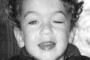 Photograph showing congenital ptosis in the left eye. The eyelid droops over the eye, partially obscuring vision. Style attribute: opacity set to 0.7.